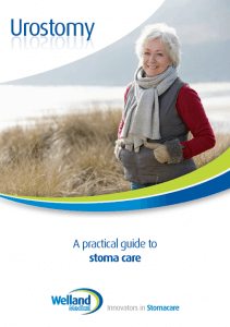 urostomy guide