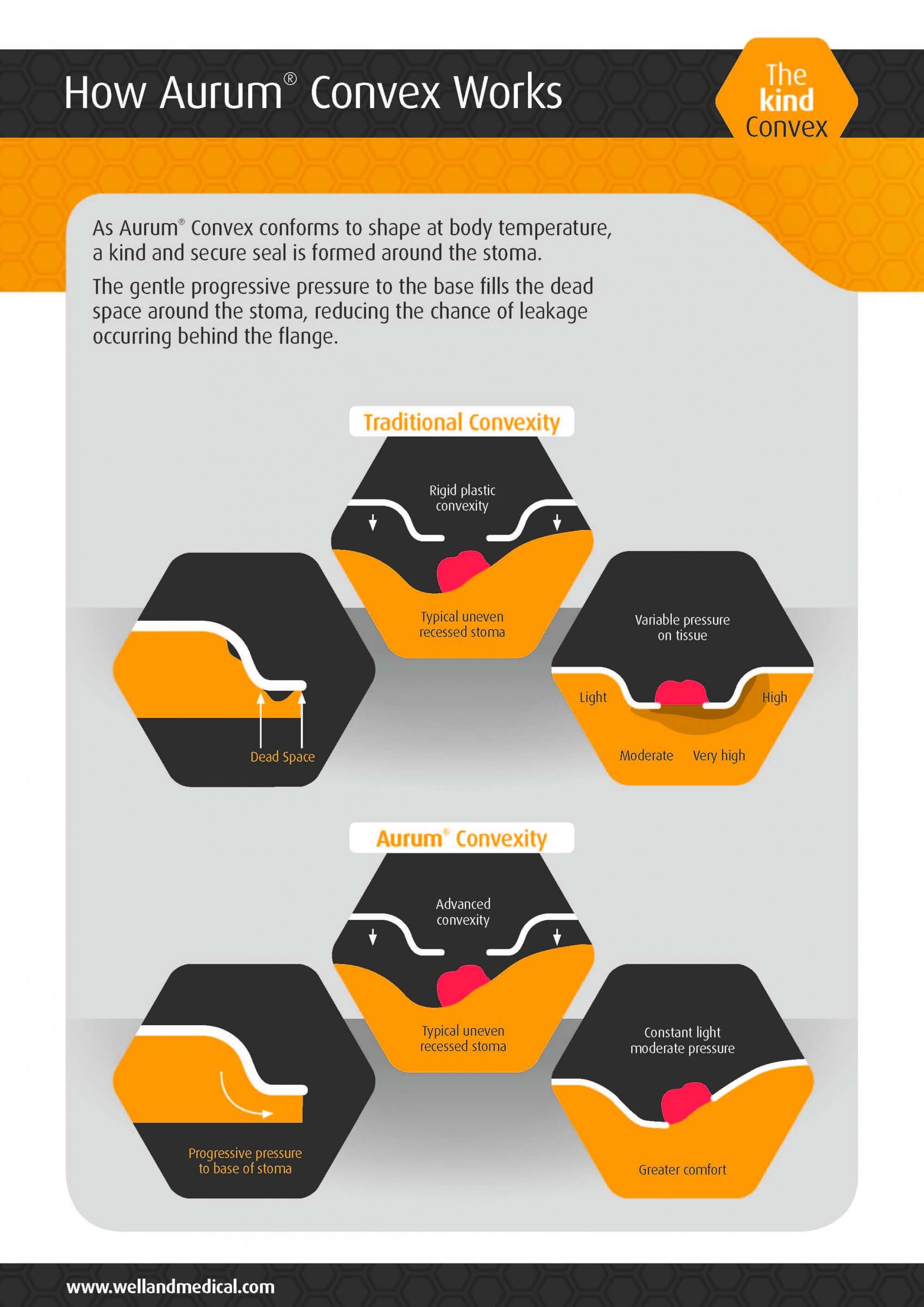 Aurum Convex Ostomy Bags Welland Medical