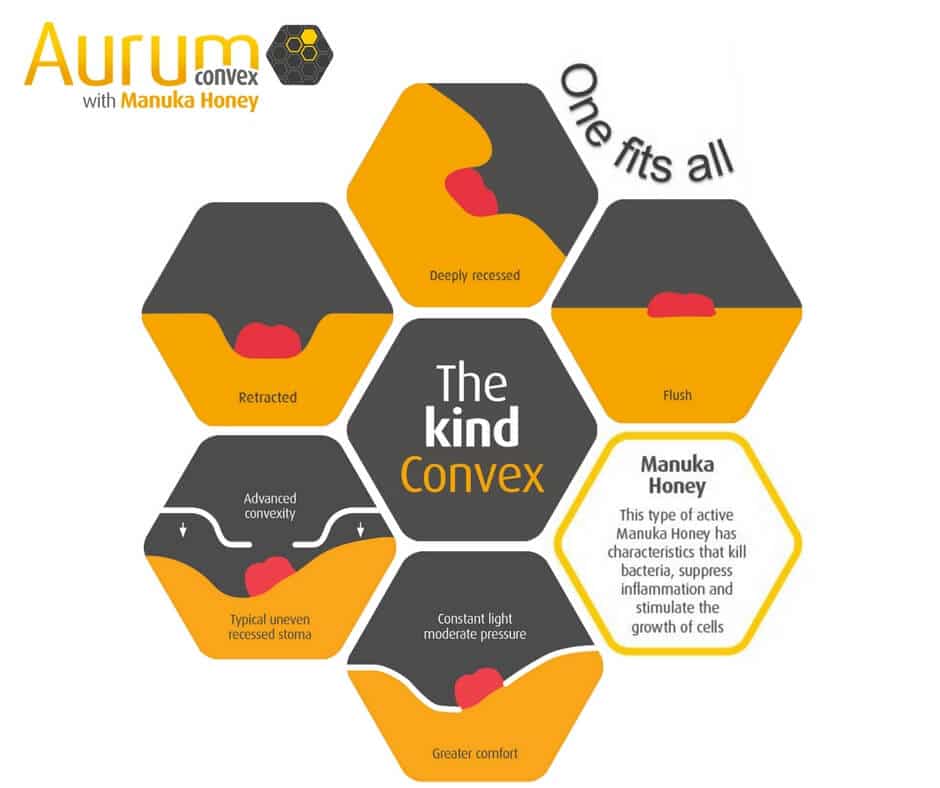 The Kind Convex hex